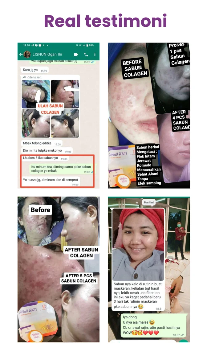 Sabun Colagen - Beauty Bahagia